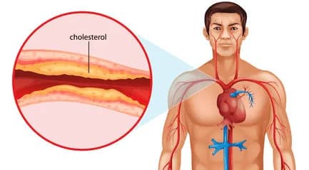 What is Cholesterol?